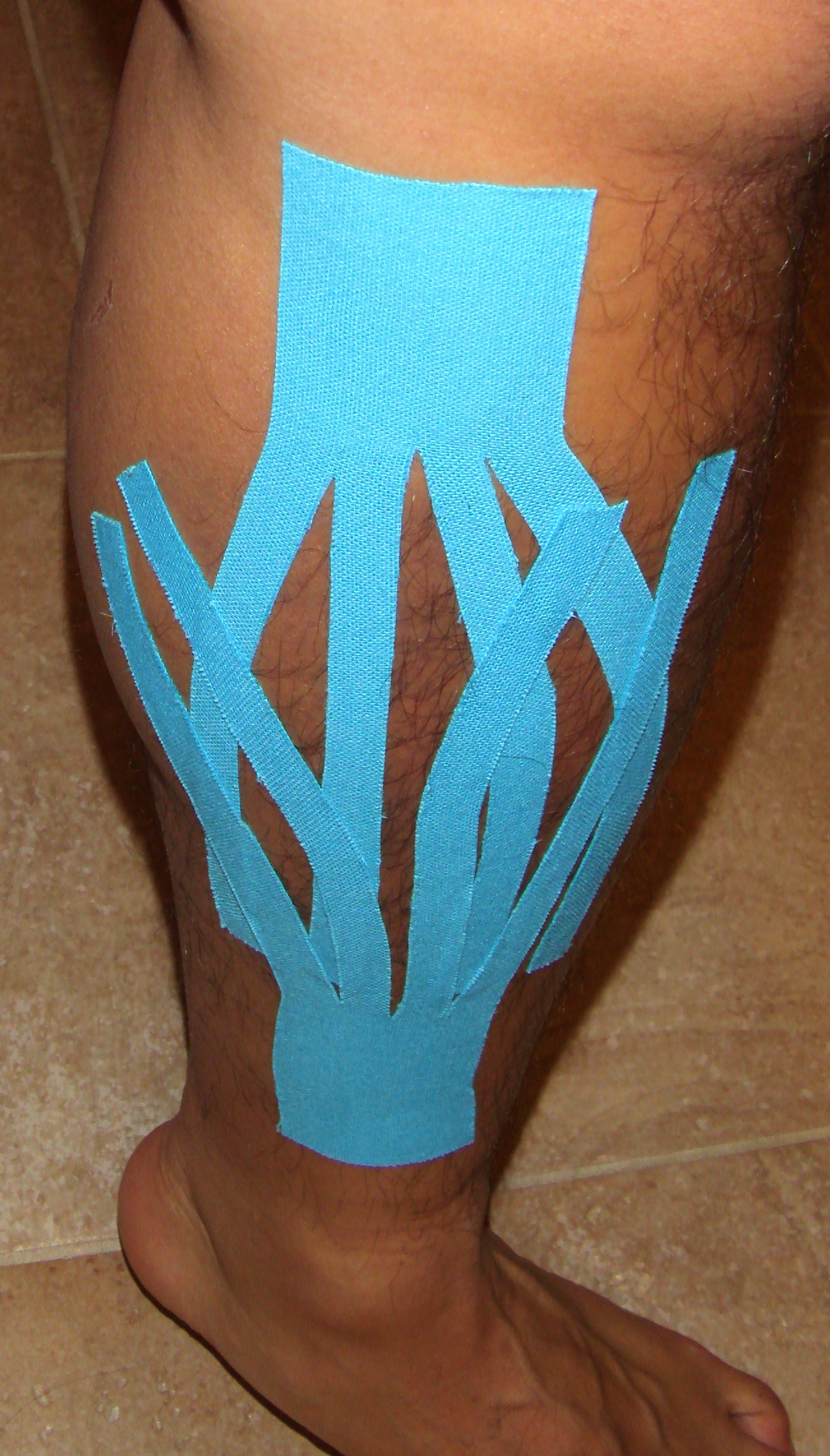 kinesio
